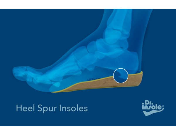 bone spur insoles