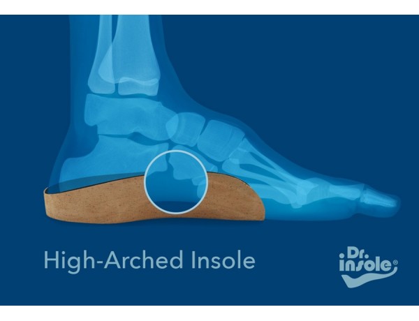 best orthotics for high arches