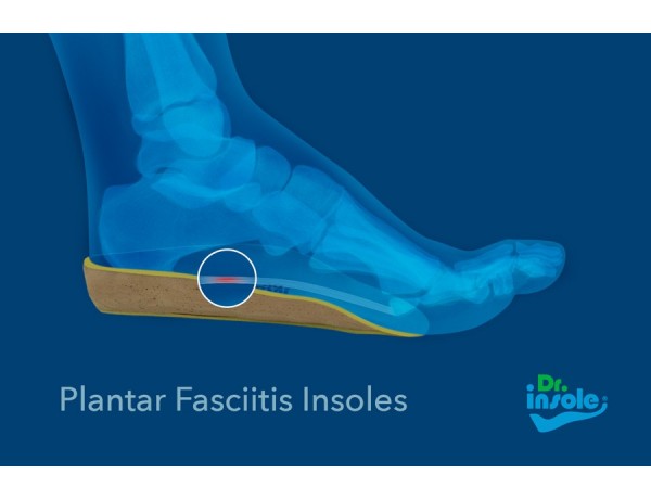 heel pads for plantar fasciitis uk
